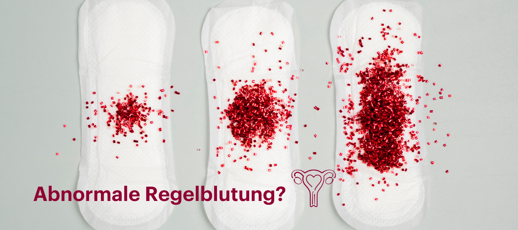 Die Menstruation – Was sind Blutungsstörungen?